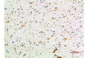 Immunohistochemical analysis of paraffin-embedded human-brain, antibody was diluted at 1:200 (FCGR1A 抗体  (AA 230-280))