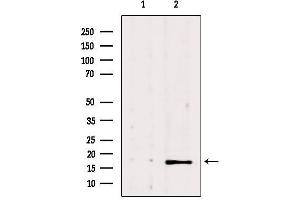 Western blot analysis of extracts from 293, using NME1 Antibody. (NME1 抗体  (C-Term))