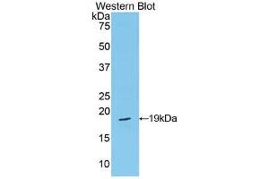 Western blot analysis of the recombinant protein. (Periostin 抗体  (AA 659-810))