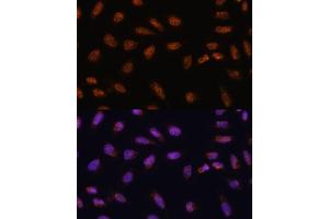 Immunofluorescence analysis of U-2 OS cells using SARNP antibody (ABIN6130106, ABIN6147381, ABIN6147382 and ABIN6217793) at dilution of 1:100. (SARNP 抗体  (AA 1-210))