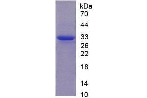 SDS-PAGE analysis of Rat CAPN1 Protein. (CAPNL1 蛋白)