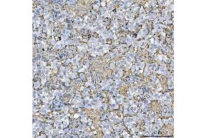 IHC analysis of HLA-DRA using anti-HLA-DRA antibody (ABIN7600948). (HLA-DRA 抗体  (AA 26-254))