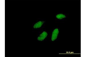 Immunofluorescence of purified MaxPab antibody to RAD1 on HeLa cell. (RAD1 抗体  (AA 1-282))