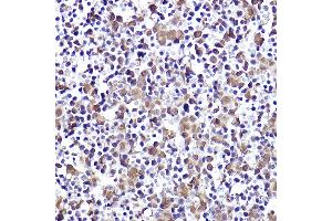 Immunohistochemistry of paraffin-embedded mouse fetal liver using CMIP Rabbit pAb (ABIN7265970) at dilution of 1:50 (40x lens). (CMIP 抗体)