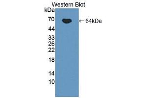 Western blot analysis of the recombinant protein. (IL12B 抗体  (AA 23-324))