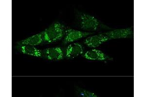 Confocal immunofluorescence analysis of NIH-3T3 cells using ACSS2 Polyclonal Antibody at dilution of 1:200. (ACSS2 抗体)