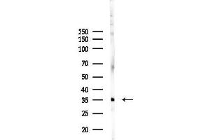 Western blot analysis of lysates from EC304 cells, using OR52R1 Antibody at 1/1000 dilution.