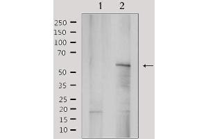 Western blot analysis of extracts from rat brain, using YTHDF1 Antibody. (YTHDF1 抗体  (N-Term))