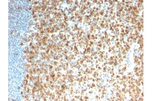 Formalin-fixed, paraffin-embedded human Tonsil stained with MCM7 Recombinant Mouse Monoclonal Antibody (rMCM7/1468). (Recombinant MCM7 抗体  (AA 195-319))