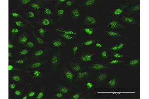 Immunofluorescence of monoclonal antibody to PIK3CB on HeLa cell. (PIK3CB 抗体  (AA 147-256))