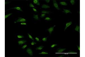Immunofluorescence of monoclonal antibody to PRKRIP1 on HeLa cell. (PRKRIP1 抗体  (AA 1-184))