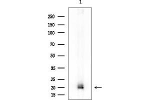 Western blot analysis of lysates from Rat liver, using NAA40 Mouse Monoclonal Antibody at 1/1000 dilution.