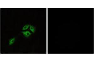 Immunofluorescence analysis of A549 cells, using NMBR Antibody. (NMBR 抗体  (AA 221-270))