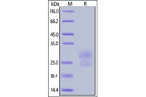 SDS-PAGE (SDS) image for Inducible T-Cell Co-Stimulator (ICOS) (AA 21-144) (Active) protein (His tag) (ABIN6809884)
