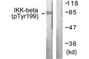Western blot analysis of extracts from HeLa cells treated with TNF-a 20ng/ml+Calyculin A 50nM 5', using IKK-beta (Phospho-Tyr199) Antibody. (IKBKB 抗体  (pTyr199))