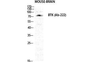 Western Blot (WB) analysis of specific cells using Btk Polyclonal Antibody. (BTK 抗体  (Ser189))
