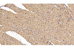 Detection of VEGFA in Rat Cardiac Muscle Tissue using Polyclonal Antibody to Vascular Endothelial Growth Factor A (VEGFA) (VEGFA 抗体  (AA 27-190))