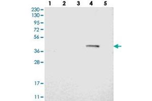 Western blot analysis of Lane 1: RT-4, Lane 2: U-251 MG, Lane 3: Human Plasma, Lane 4: Liver, Lane 5: Tonsil with BTN3A1 polyclonal antibody  at 1:250-1:500 dilution. (BTN3A1 抗体)