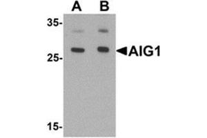 Western blot analysis of AIG1 in human brain tissue lysate with AIG1 antibody at (A) 1 and (B) 2 ug/mL. (AIG1 抗体  (N-Term))