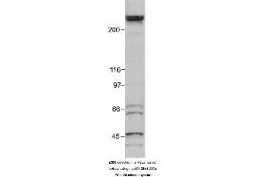 Image no. 1 for anti-E1A Binding Protein P300 (EP300) (AA 1572-2371) antibody (ABIN363280) (p300 抗体  (AA 1572-2371))