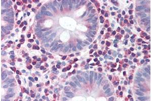 Human Colon (formalin-fixed, paraffin-embedded) stained with IRGM antibody ABIN351455 at 5 ug/ml followed by biotinylated goat anti-rabbit IgG secondary antibody ABIN481713, alkaline phosphatase-streptavidin and chromogen. (IRGM 抗体  (Internal Region))