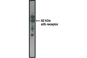 Western blot analysis using alpha2B adrenergic receptor antibody on  MDCK cells transfected to produce alpha2B receptor protein. (RGR 抗体  (Intracellular))