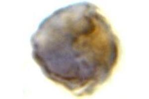 Immunocytochemistry of TLR8 in Daudi cells with this product at 2 μg/ml. (TLR8 抗体  (Middle Region))