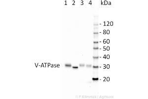 Western Blotting (WB) image for anti-ATPase, H+ Transporting, Lysosomal 38kDa, V0 Subunit D2 (ATP6V0D2) (Isoform 1) antibody (ABIN3197488)