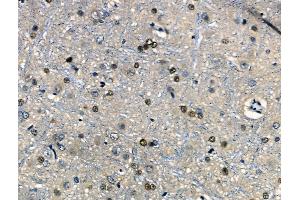 ABIN6262248 and ABIN6266737 at 1/100 staining Rat brain tissue by IHC-P. (Histone H1 抗体  (Internal Region))
