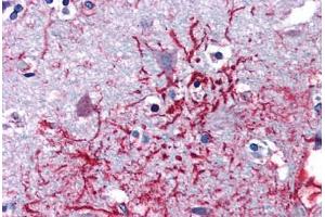 Human Brain, Cortex (formalin-fixed, paraffin-embedded) stained with DHX58 antibody ABIN351452 at 5 ug/ml followed by biotinylated goat anti-rabbit IgG secondary antibody ABIN481713, alkaline phosphatase-streptavidin and chromogen. (DHX58 抗体  (Internal Region))