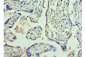 Immunohistochemistry of paraffin-embedded human placenta tissue using ABIN7144363 at dilution of 1:100