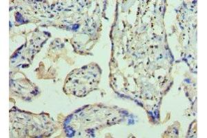 Immunohistochemistry of paraffin-embedded human placenta tissue using ABIN7144363 at dilution of 1:100 (AP2B1 抗体  (AA 738-937))