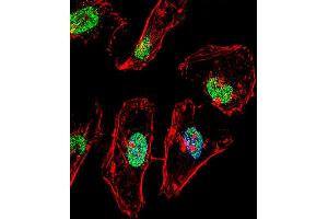 Fluorescent confocal image of Hela cell stained with TBX6 Antibody (Center) (ABIN656001 and ABIN2845380). (T-Box 6 抗体  (AA 264-293))