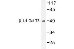 Image no. 1 for anti-UDP-Gal:betaGlcNAc beta 1,4- Galactosyltransferase, Polypeptide 3 (B4GALT3) antibody (ABIN317820)