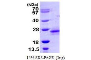 SDS-PAGE (SDS) image for Ras Homolog Family Member D (RHOD) (AA 18-207) protein (His tag) (ABIN6386731) (RHOD Protein (AA 18-207) (His tag))