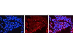 Immunohistochemistry (IHC) image for anti-Activating Transcription Factor 2 (ATF2) (C-Term) antibody (ABIN2778291)
