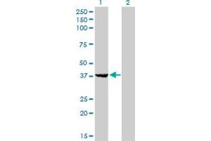 Western Blot analysis of EIF2B2 expression in transfected 293T cell line by EIF2B2 monoclonal antibody (M01), clone 5B12-E10. (EIF2B2 抗体  (AA 1-351))