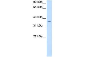 PON1 antibody used at 0. (PON1 抗体  (C-Term))