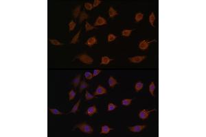 Immunofluorescence analysis of L929 cells using LSM1 antibody (ABIN6131868, ABIN6143353, ABIN6143354 and ABIN6216476) at dilution of 1:100. (LSM1 抗体  (AA 1-133))