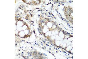 Immunohistochemistry of paraffin-embedded human colon using NAA60 antibody at dilution of 1:200 (40x lens). (NAT15 抗体)