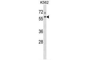 TBL1XR1 Antibody (N-term) western blot analysis in K562 cell line lysates (35µg/lane). (TBL1XR1 抗体  (N-Term))