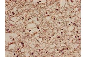 Immunohistochemistry of paraffin-embedded human brain tissue using ABIN7168220 at dilution of 1:100 (NQO2 抗体  (AA 1-231))