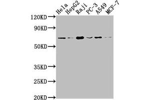 Western Blot Positive WB detected in: Hela whole cell lysate, HepG2 whole cell lysate, Raji whole cell lysate, PC-3 whole cell lysate, A549 whole cell lysate, MCF-7 whole cell lysate All lanes: ALAS1 antibody at 1:1500 Secondary Goat polyclonal to rabbit IgG at 1/50000 dilution Predicted band size: 71, 13 kDa Observed band size: 71 kDa (Recombinant ALAS1 抗体)