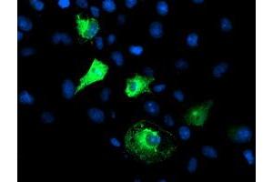 Anti-FBXO21 mouse monoclonal antibody (ABIN2455367) immunofluorescent staining of COS7 cells transiently transfected by pCMV6-ENTRY FBXO21 (RC223095). (FBXO21 抗体)