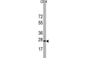 Western Blotting (WB) image for anti-BARX Homeobox 1 (BARX1) antibody (ABIN3003108) (BARX1 抗体)