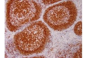 Immunohistochemistry (IHC) image for anti-Paired Box 5 (PAX5) (AA 235-382) antibody (ABIN6940256)