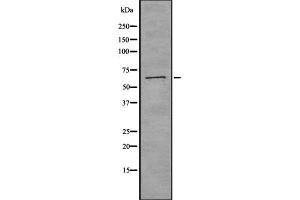 Western blot analysis of CTPS using K562 whole cell lysates (CTP Synthase 抗体  (C-Term))