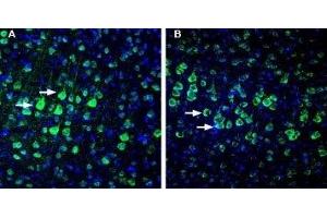 Expression of NETO1 in rat and mouse cortex. (NETO1 抗体  (Extracellular))