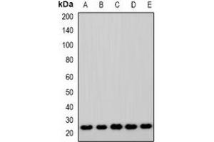 Western blot analysis of ASF1A expression in Jurkat (A), A549 (B), MCF7 (C), mouse lung (D), rat lung (E) whole cell lysates. (ASF1A 抗体)