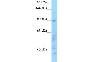 WB Suggested Anti-SECISBP2 Antibody Titration: 1. (SECISBP2 抗体  (N-Term))